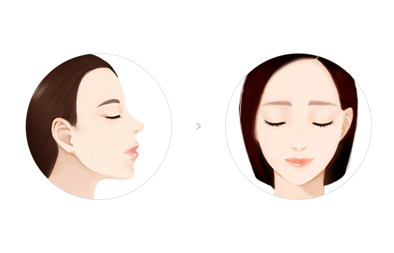 일반적인 헤어라인 디자인 비교 이미지