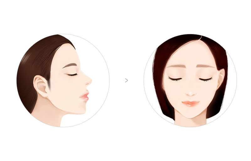 경대뉴보자르의원 작은 얼굴 헤어라인 디자인