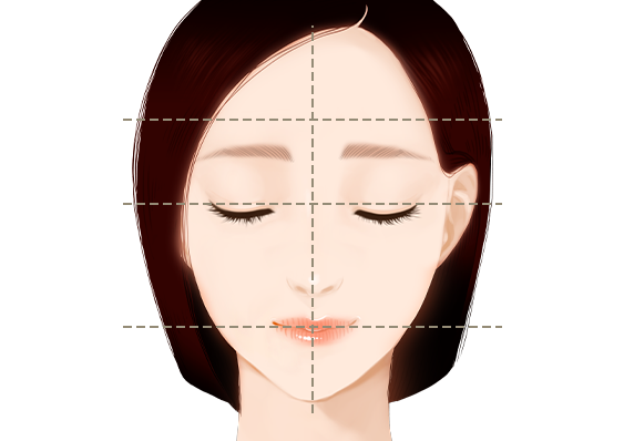 비대칭 헤어라인 교정 후